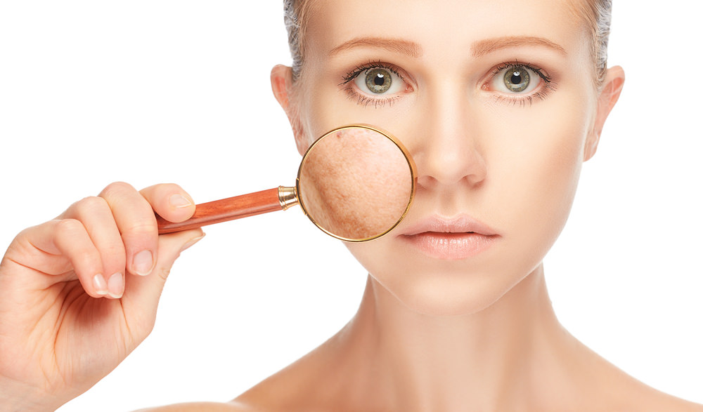 Pigmentation Treatment in Nashik