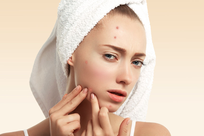 Pimples Treatment in College Road Nashik