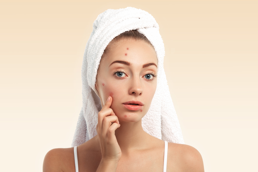 Pimples Treatment in Nashik