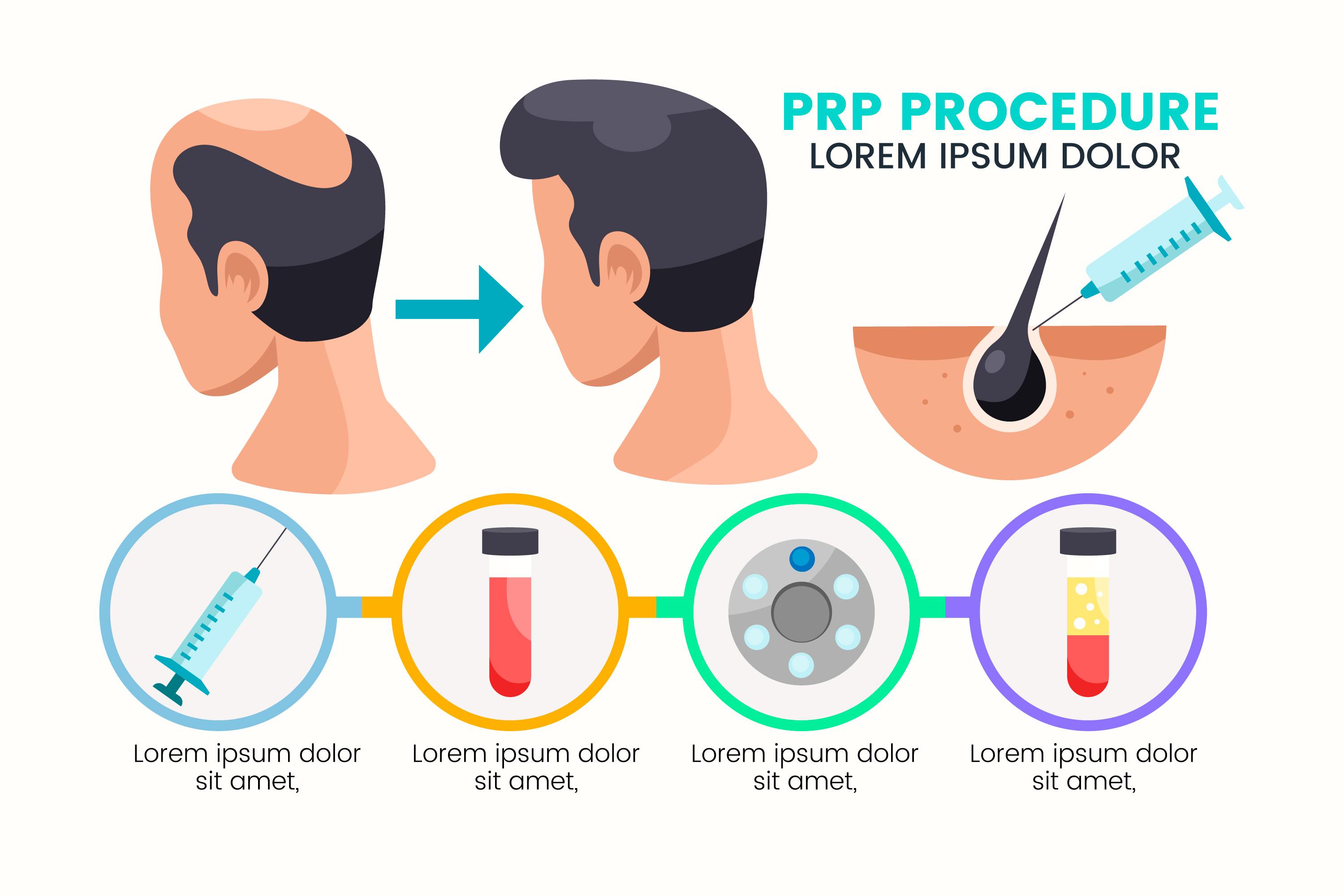 PRP Treatment in Indira Nagar Nashik